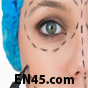 .SOME REASON FOR DOING COSMETIC SURGERY